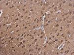 PKC beta Antibody in Immunohistochemistry (Paraffin) (IHC (P))