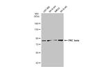 PKC beta Antibody in Western Blot (WB)