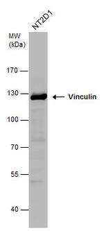 Vinculin Antibody in Western Blot (WB)