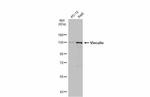 Vinculin Antibody in Western Blot (WB)