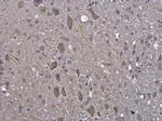 GRP78 Antibody in Immunohistochemistry (Paraffin) (IHC (P))