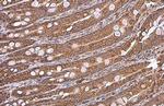 GRP78 Antibody in Immunohistochemistry (Paraffin) (IHC (P))