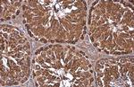 GRP78 Antibody in Immunohistochemistry (Paraffin) (IHC (P))