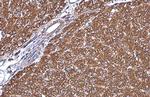 GRP78 Antibody in Immunohistochemistry (Paraffin) (IHC (P))