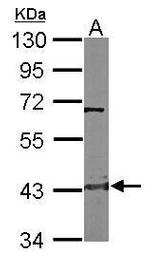 CTH Antibody in Western Blot (WB)