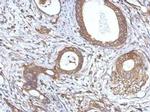 NF2 Antibody in Immunohistochemistry (Paraffin) (IHC (P))