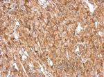 NF2 Antibody in Immunohistochemistry (Paraffin) (IHC (P))