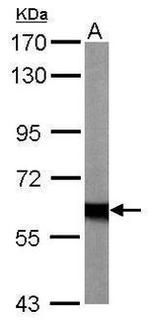 NF2 Antibody in Western Blot (WB)