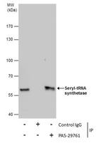Seryl-tRNA synthetase Antibody in Immunoprecipitation (IP)