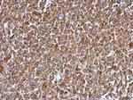 ST14 Antibody in Immunohistochemistry (Paraffin) (IHC (P))