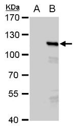 PMS2 Antibody in Western Blot (WB)