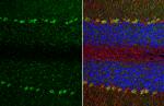 TRPC6 Antibody in Immunohistochemistry (Paraffin) (IHC (P))