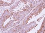 ADAMTS1 Antibody in Immunohistochemistry (Paraffin) (IHC (P))