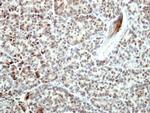 Bcl-B Antibody in Immunohistochemistry (Paraffin) (IHC (P))