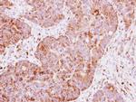 IGF2BP2 Antibody in Immunohistochemistry (Paraffin) (IHC (P))