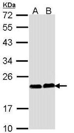 CHP1 Antibody in Western Blot (WB)