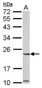 CHP1 Antibody in Western Blot (WB)