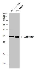 V-ATPase E1 Antibody in Western Blot (WB)