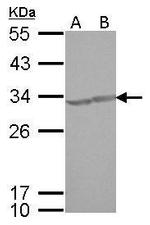 CREM Antibody in Western Blot (WB)