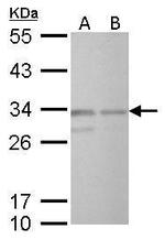 CREM Antibody in Western Blot (WB)