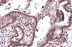 CRM1 Antibody in Immunohistochemistry (Paraffin) (IHC (P))