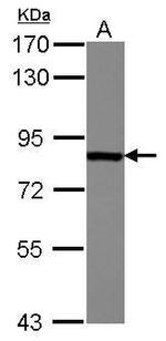 Radixin Antibody in Western Blot (WB)