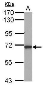 ALAS1 Antibody in Western Blot (WB)