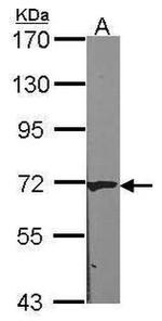 CAT1 Antibody in Western Blot (WB)