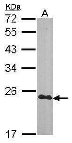 CRIP2 Antibody in Western Blot (WB)