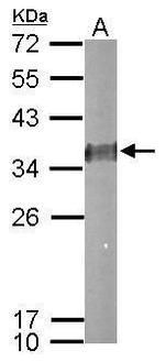 ESD Antibody in Western Blot (WB)