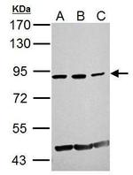 GCN5 Antibody in Western Blot (WB)