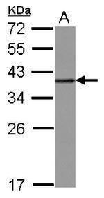 hnRNP A2B1 Antibody in Western Blot (WB)