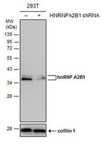 hnRNP A2B1 Antibody