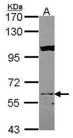 KPNA3 Antibody in Western Blot (WB)