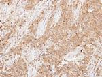 LCN1 Antibody in Immunohistochemistry (Paraffin) (IHC (P))