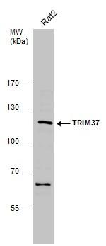 TRIM37 Antibody in Western Blot (WB)