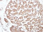 NFIC Antibody in Immunohistochemistry (Paraffin) (IHC (P))