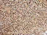 PCBP2 Antibody in Immunohistochemistry (Paraffin) (IHC (P))