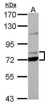 PCCA Antibody in Western Blot (WB)