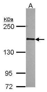 POLR2B Antibody in Western Blot (WB)