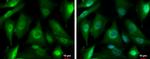 PSMD4 Antibody in Immunocytochemistry (ICC/IF)