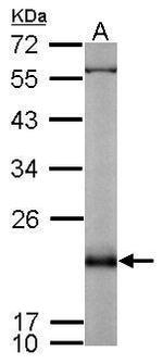 RAP2B Antibody in Western Blot (WB)