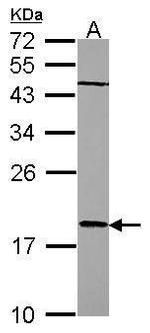 RARRES3 Antibody in Western Blot (WB)