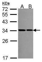 RPS2 Antibody in Western Blot (WB)