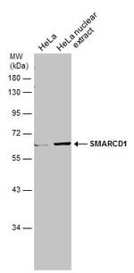 SMARCD1 Antibody in Western Blot (WB)