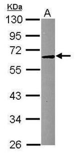 ASM Antibody in Western Blot (WB)