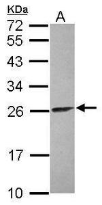 ATP Synthase B1 Antibody in Western Blot (WB)