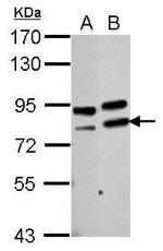 PARN Antibody in Western Blot (WB)