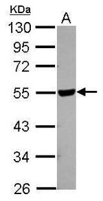 HYAL2 Antibody in Western Blot (WB)