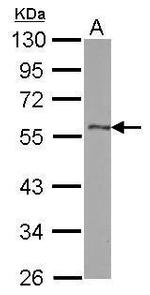 DLK1 Antibody in Western Blot (WB)